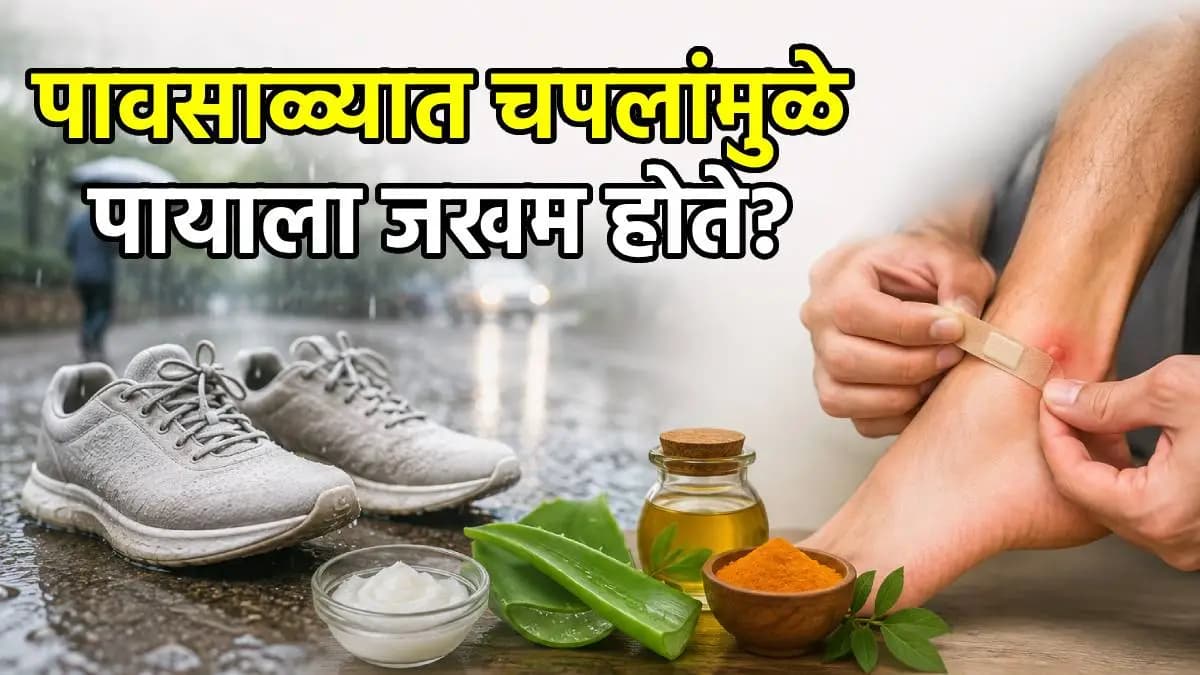 How to Prevent Shoe Bites: चपलांमुळे पायाला जखम होण्यापासून वाचण्यासाठी उपाय