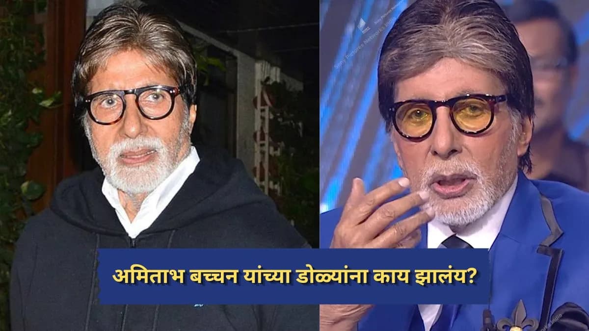 Amitabh Bachchan's Eye Condition: अमिताभ बच्चन यांच्या डोळ्यांची स्थिती