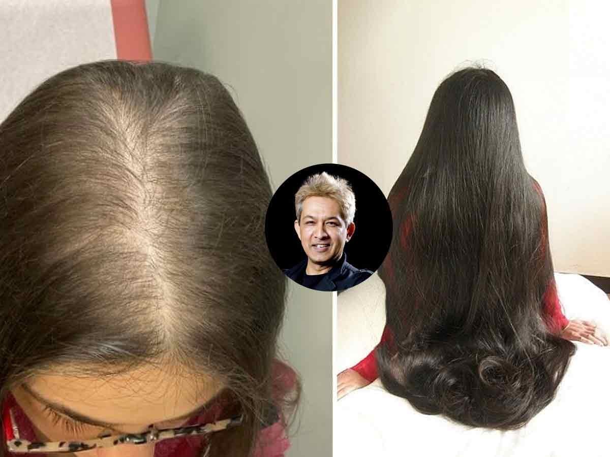Hair Fall Solutions:केस गळणं थांबविण्यासाठी ३ सोपे उपाय