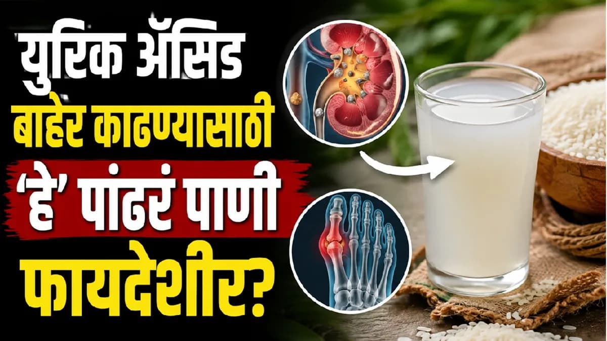 Uric Acid Remedies:युरिक अॅसिड वाढलंय? ‘हे’ पांढरं पाणी ठरेल फायदेशीर; तज्ज्ञांनी सांगितलं कसं प्यावं